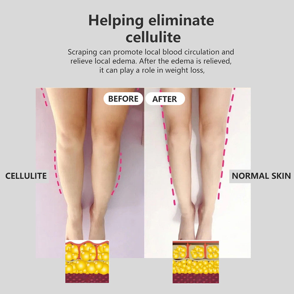Fashion Intelligent Electric Gua Sha Instrument